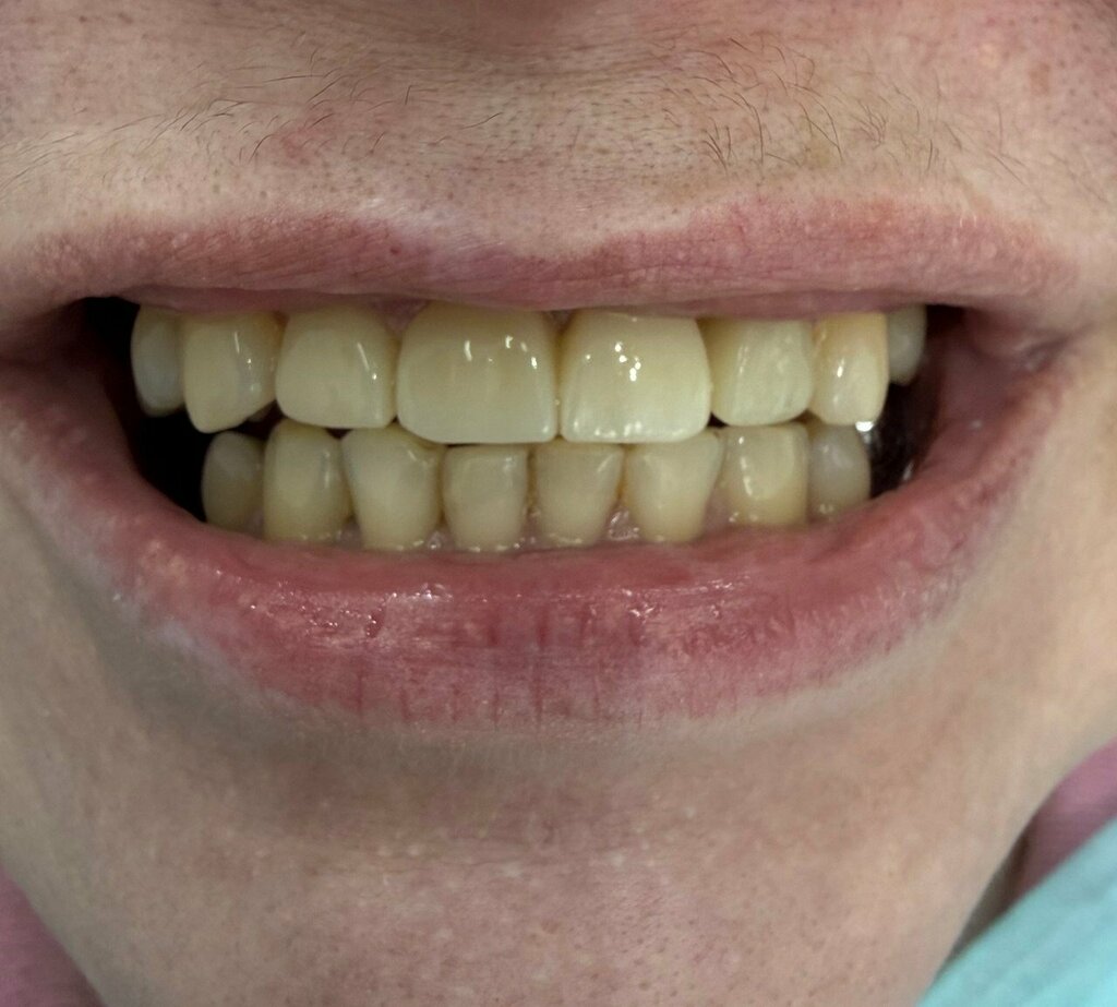 Фото пациентки Инны Беловской — результат лечения